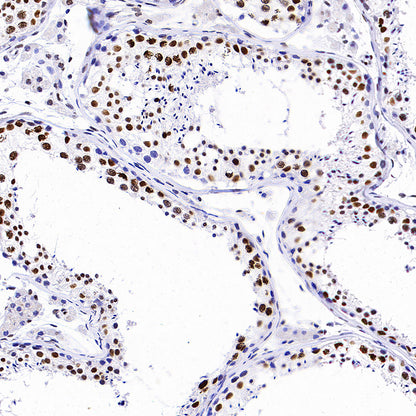 TriMethyl-Histone H3 (K36) Recombinant Rabbit mAb (S-M0025)