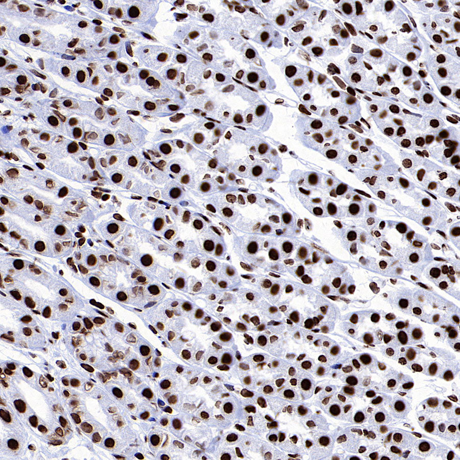 Histone H3 (tri methyl K27) Recombinant Rabbit mAb (S-4331)
