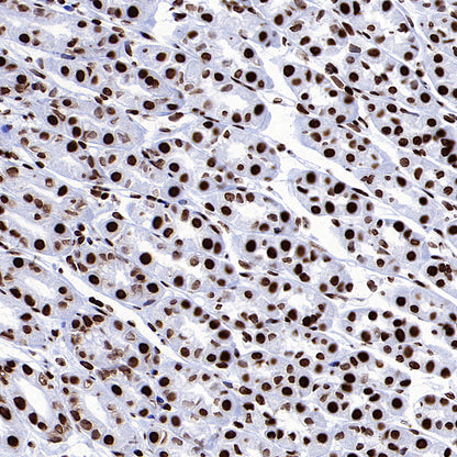 Histone H3 (tri methyl K27) Recombinant Rabbit mAb (S-4331)