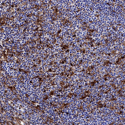 Galectin-1/LGALS1 Rabbit Polyclonal Antibody