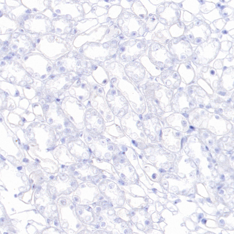 CaV2.3 (CACNA1E) Recombinant Rabbit mAb (S-3244-59)