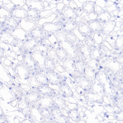 CaV2.3 (CACNA1E) Recombinant Rabbit mAb (S-3244-59)