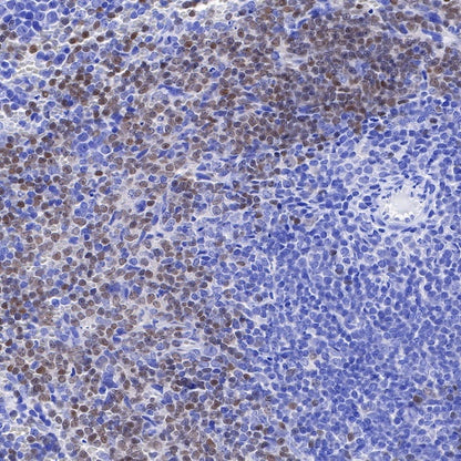 PAX5 Recombinant Rat mAb (S-R200)