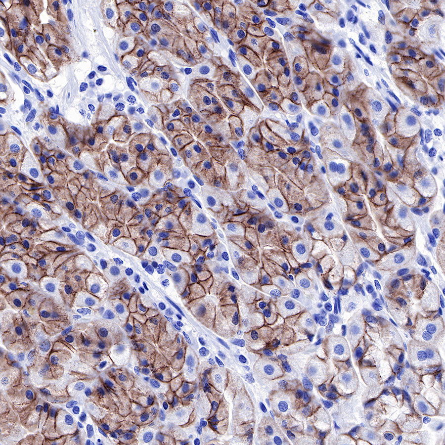 S-RMab® E-Cadherin Recombinant Rabbit mAb (SDT-R088)