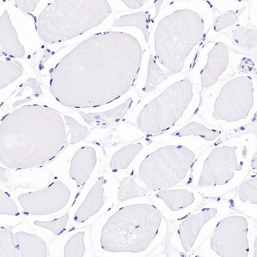 CDK2 Recombinant Rabbit mAb (S-1308-13)