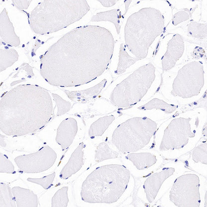 CDK2 Recombinant Rabbit mAb (S-1308-13)