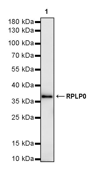 RPLP0 Rabbit Polyclonal Antibody