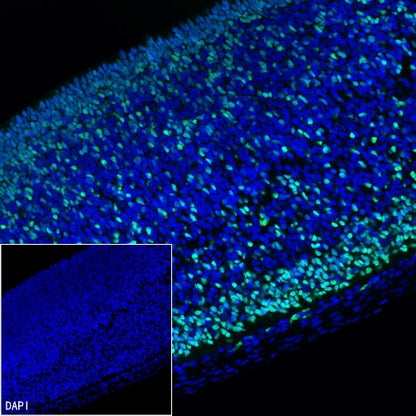 OTX2 Recombinant Rabbit mAb (S-2095-8)