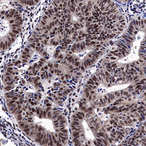 Estrogen Receptor β Recombinant Rabbit mAb (S-1396-67）
