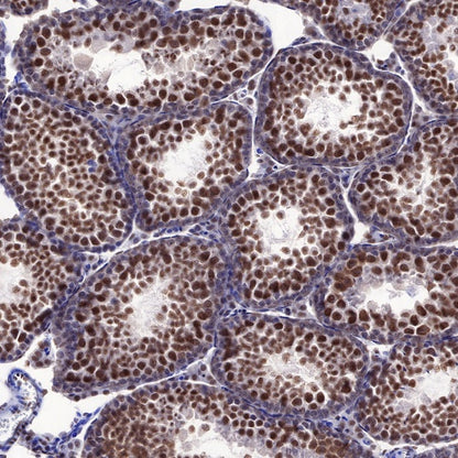 EWSR1/EWS Recombinant Rat mAb (S-R201)