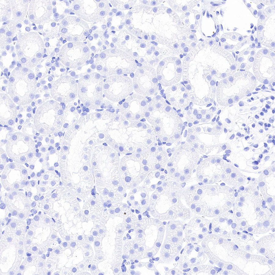 Thyroglobulin Recombinant Rabbit mAb (SDT-209-297)