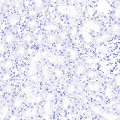 Thyroglobulin Recombinant Rabbit mAb (SDT-209-297)