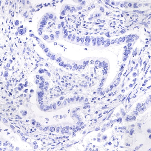 Synapsin-1 Recombinant Rabbit mAb (S-550-7)