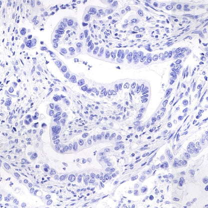Synapsin-1 Recombinant Rabbit mAb (S-550-7)