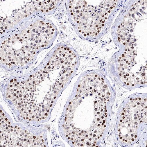 MLH1 Recombinant Mouse mAb,PBS Only (SDT-R702)