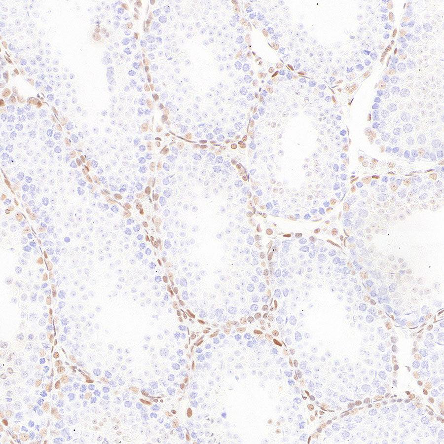 RAD21 Recombinant Rabbit mAb (S-4271-136)