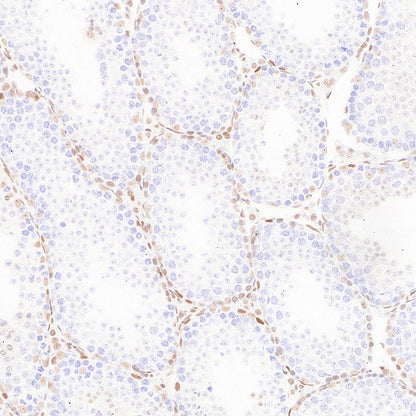 RAD21 Recombinant Rabbit mAb (S-4271-136)