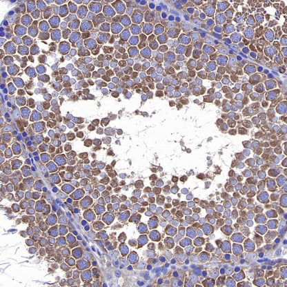 GSPT1 Recombinant Rabbit mAb (S-1914-49)