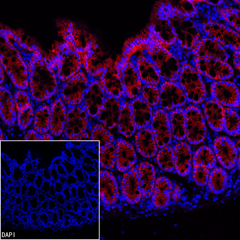 EpCAM Recombinant Rabbit mAb (PE Conjugate) (S-078-128)