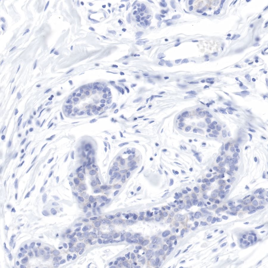S-RMab® ErbB2 Recombinant Rabbit mAb (SDT-069-57)