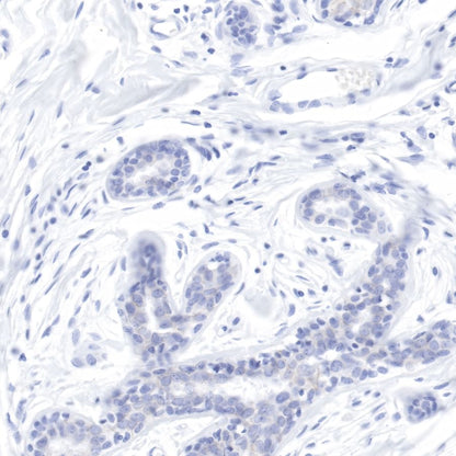 S-RMab® ErbB2 Recombinant Rabbit mAb (SDT-069-57)
