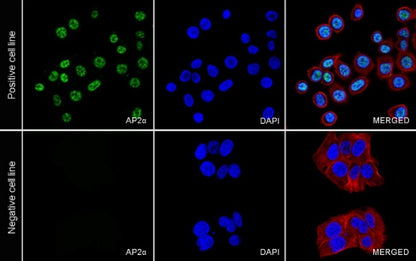 AP2α Recombinant Rabbit mAb (S-2376-7)