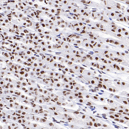 RNF40 Recombinant Rabbit mAb (S-1068-279)