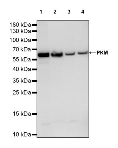 PKM Recombinant Rabbit mAb (S-812-20)