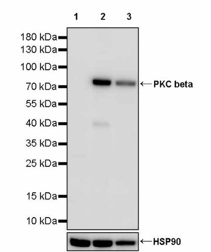 PKC beta Recombinant Rabbit mAb (S-3158-28)