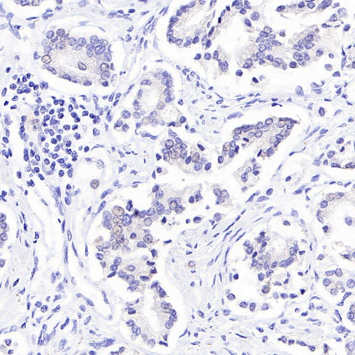 ErbB3 Recombinant Rabbit mAb (SDT-991-14)