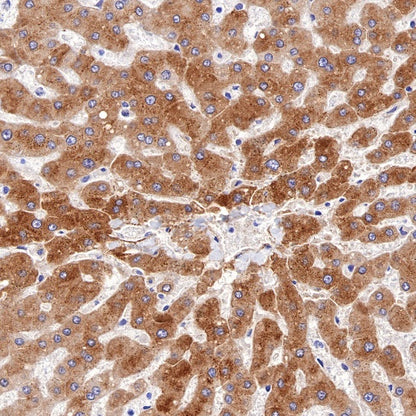 RBP4 Recombinant Rabbit mAb (S-693-111)