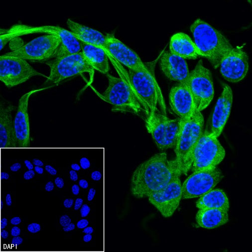 TUBA1B Rabbit Polyclonal Antibody