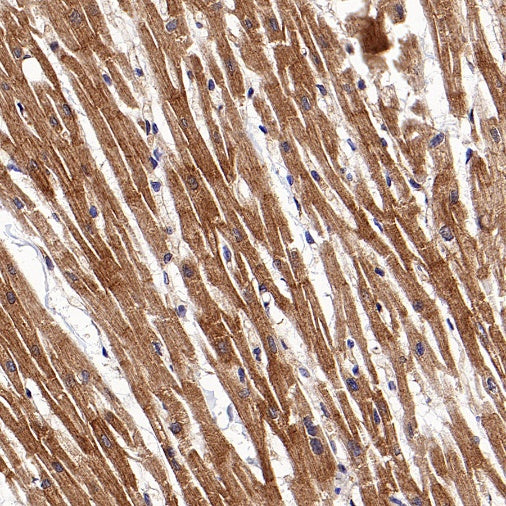 Mitofusin 2 Recombinant Rabbit mAb (S-1783-49)
