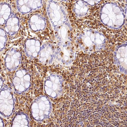 Talin-1 Recombinant Rabbit mAb (S-1483-25)