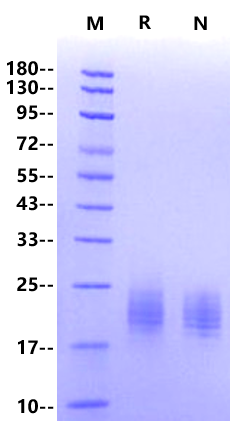 TACI/CD267/TNFRSF13B His Tag Protein, Human