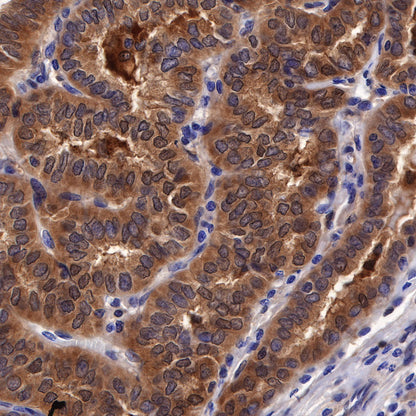 Galectin-3 Recombinant Rabbit mAb (SDT-370-111)