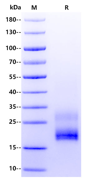 IL-31 His Tag Protein, Human