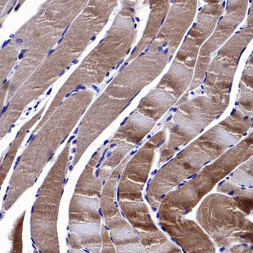 CACNA1S Recombinant Rabbit mAb (S-2448-78)