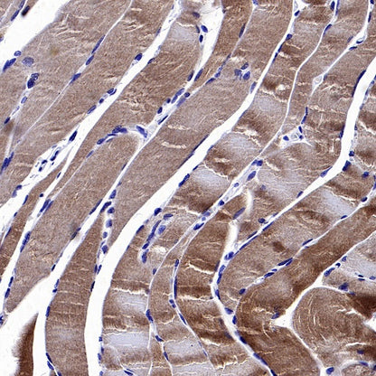 CACNA1S Recombinant Rabbit mAb (S-2448-78)