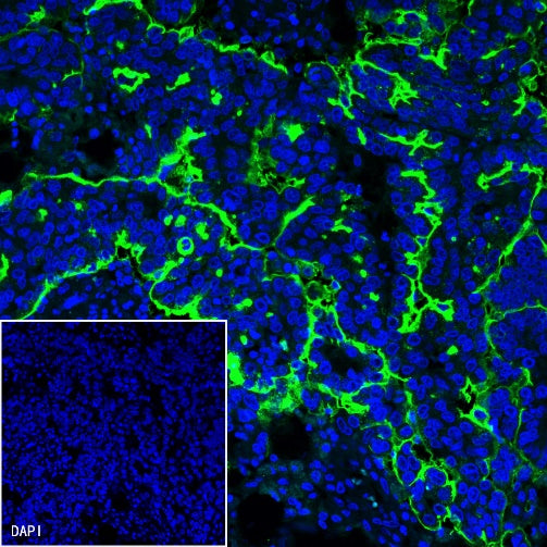 NaPi2b/SLC34A2 Recombinant Rabbit mAb (SDT-R229)