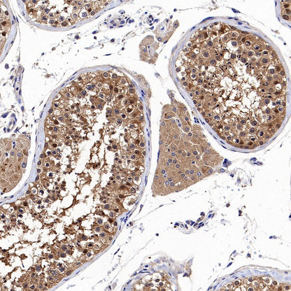 HPRT1 Rabbit Polyclonal Antibody