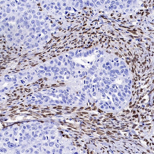FOXL2 Recombinant Rabbit mAb (SDT-557-361)