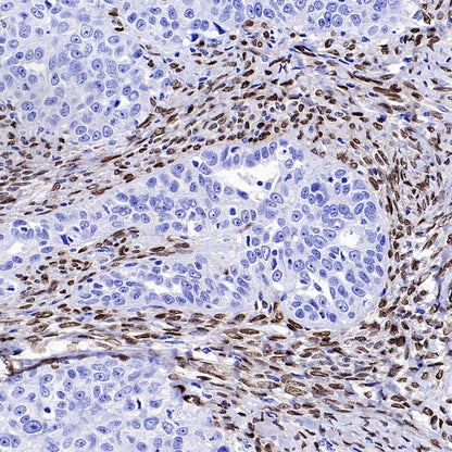FOXL2 Recombinant Rabbit mAb (SDT-557-361)