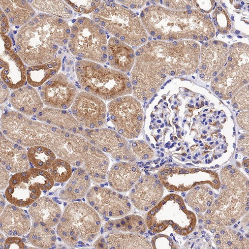 Peroxiredoxin 3 Rabbit Polyclonal Antibody