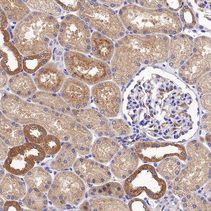 Peroxiredoxin 3 Rabbit Polyclonal Antibody