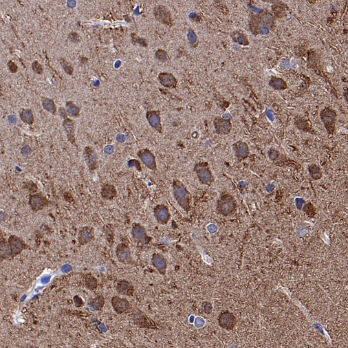 UCHL1 Rabbit Polyclonal Antibody