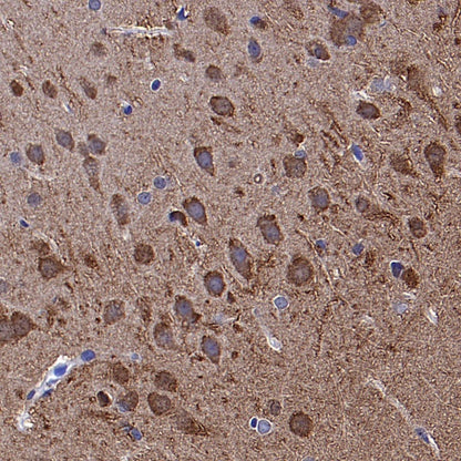 UCHL1 Rabbit Polyclonal Antibody