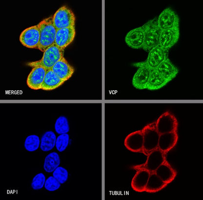 VCP Recombinant Rabbit mAb (S-1818-121)