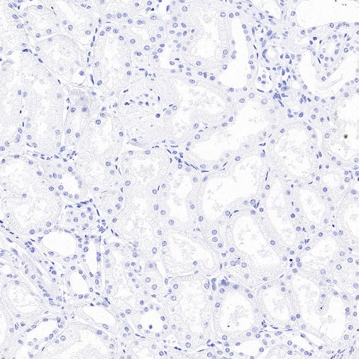 ALPP/ALPPL2 Recombinant Rabbit mAb, PBS Only (SDT-2088-32)