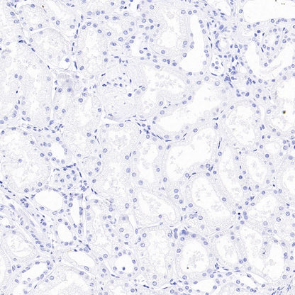 ALPP/ALPPL2 Recombinant Rabbit mAb, PBS Only (SDT-2088-32)